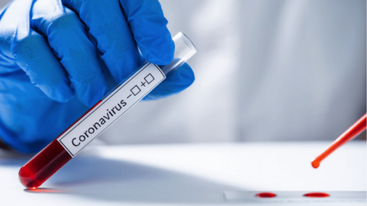 coronavirus
