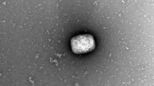 Partículas virales del virus del mono (monkeypox virus) observadas por microscopia electrónica de transmisión directamente del líquido obtenido de pústulas de pacientes infectados. EFE/ Milagros Guerra, Bruno Hernaez y Antonio Alcamí, del CBM (CSIC-UAM). EFE/ Milagros Guerra Bruno Hernaez Y Antonio Alcamí/CBM (CSIC-UAM)